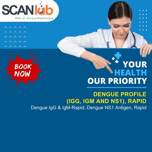 [SDL11048] DENGUE PROFILE MINI (IGG, IGM AND NS1), RAPID (SDL11048)