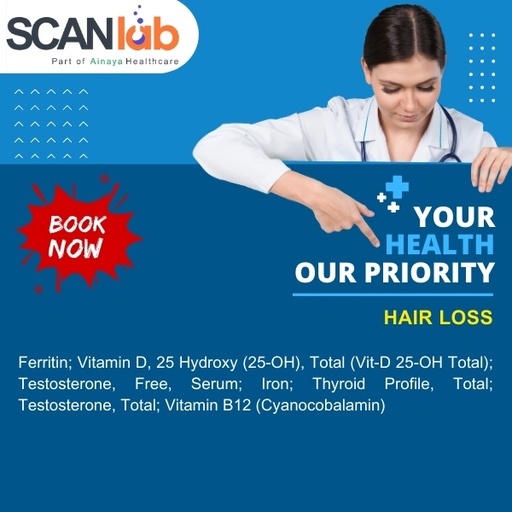 [SDL11342] HAIR LOSS (SDL11342)