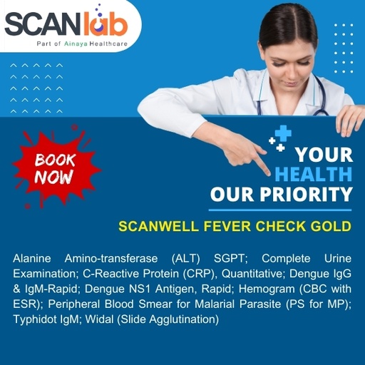 [SDL12358] SCANWELL FEVER CHECK GOLD (SDL12358)