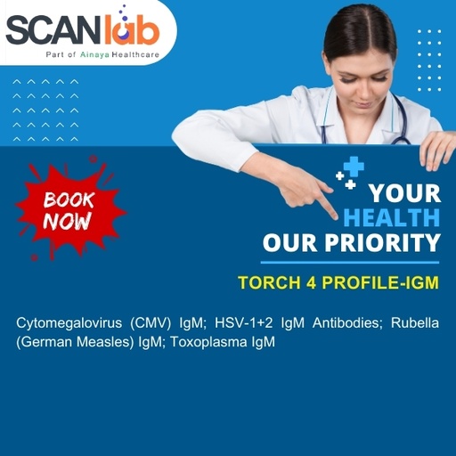 [SDL12519] TORCH 4 PROFILE, IGM (SDL12519)