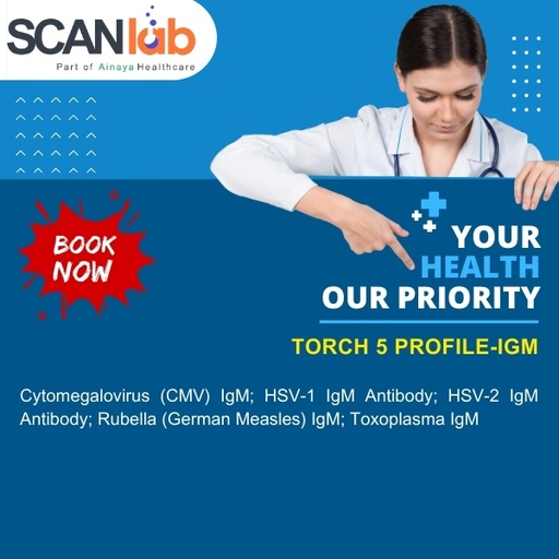 [SDL12521] TORCH 5 PROFILE, IGM (SDL12521)