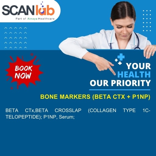 [SDL10675] BONE MARKERS (BETA CTX+P1NP) (SDL10675)