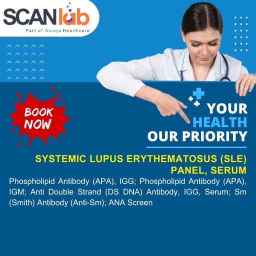 [SDL12461] SYSTEMIC LUPUS ERYTHEMATOSUS (SLE) PANEL, SERUM (SDL12461)