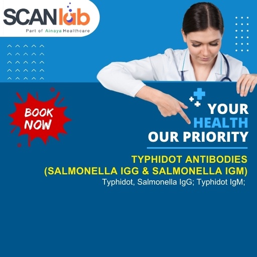[SDL12574] TYPHIDOT, ANTIBODIES (SALMONELLA IGG & SALMONELLA IGM) (SDL12574)